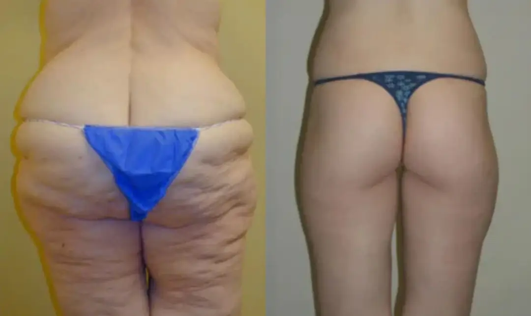 Before and after with XeiuC Collagen Oil